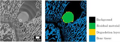 A comparison of deep learning segmentation models for synchrotron radiation based tomograms of biodegradable bone implants